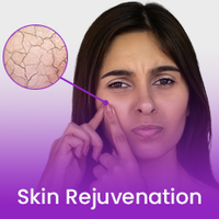 Skin Rejuvenation