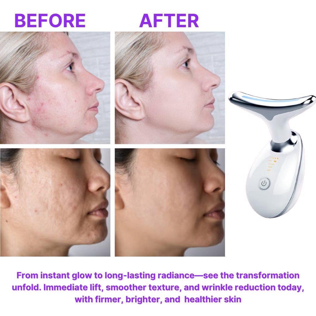 Double Chin & Wrinkle Removal Device - SKINONZ