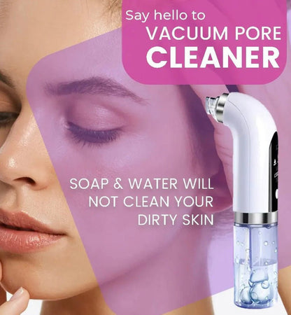 Vacuum Pore Cleaner - SKINONZ